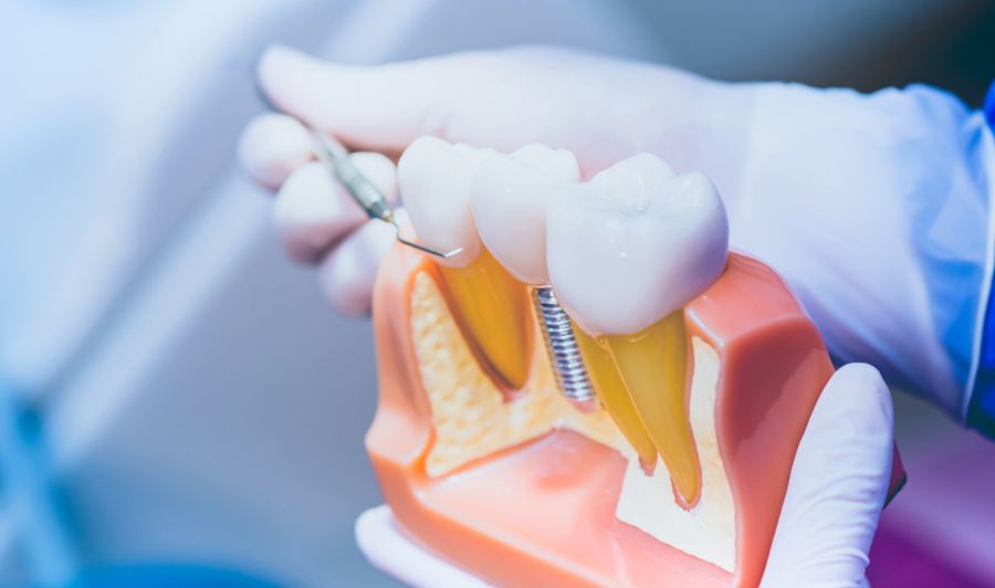 Best dental clinics Hungary for full mouth reconstruction